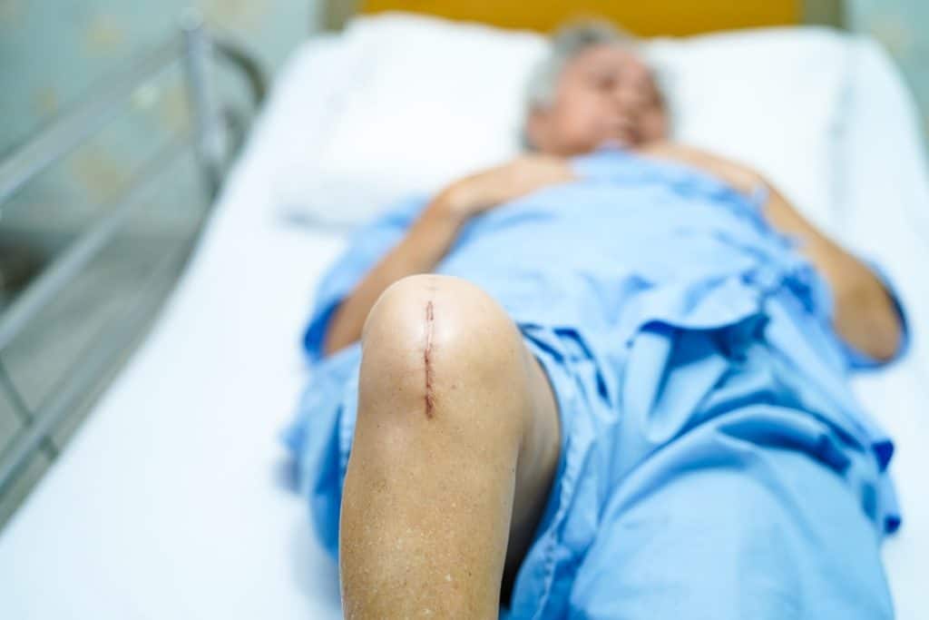 Man After Knee Surgery